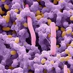 Ganz die Mutter? Gerade einmal vier Tage alt war der Produzent dieses menschlichen Stuhlgangs. In den ersten Lebensmonaten ähnelt das Mikrobiom des Babys zwar dem der Mutter. Trotzdem ist die Zusammensetzung bei jedem Menschen einzigartig