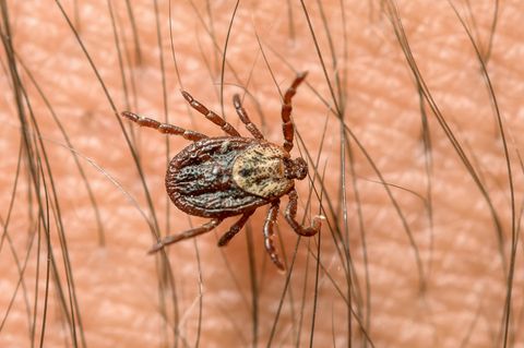 Ein Zeckenbiss kann gefährlich werden, weil er die gefährliche FSME-Krankheit übertragen kann - deshalb ist die Impfung besonders wichtig