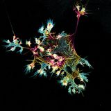 Mikrofilamente Struktur von MingShu Zhang