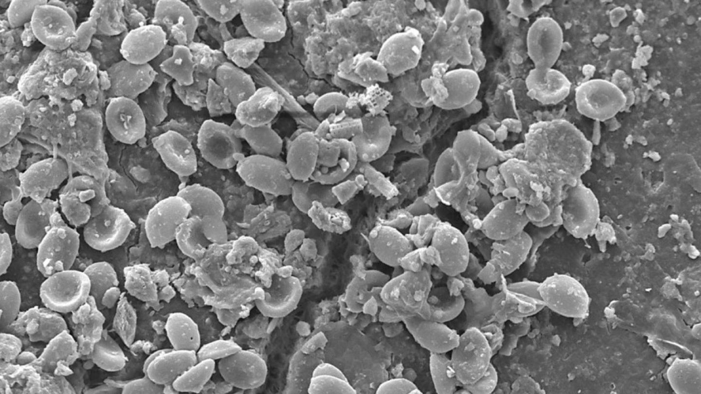 Auf diesem Bild aus dem Rasterelektronenmikroskop sind Pilzsporen entlang eines Risses in einem Mikroplastik-Partikel zu sehen. Der Maßstabsbalken entspricht 30 Mikrometern