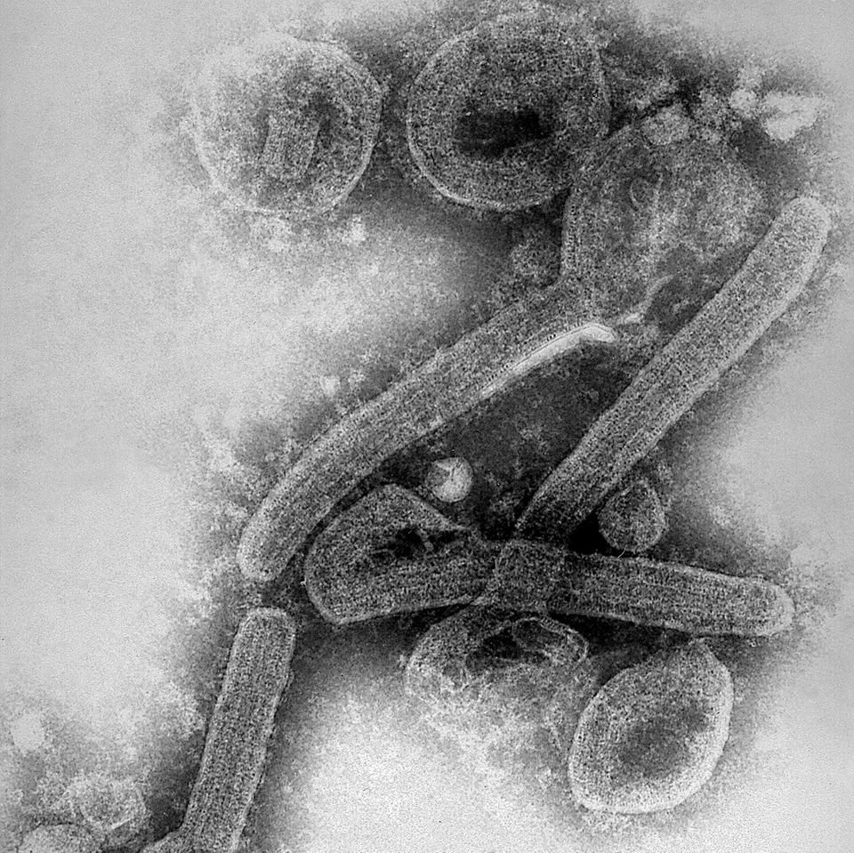Ultrastrukturelle Morphologie einer Reihe von Marburg-Virus-Virionen