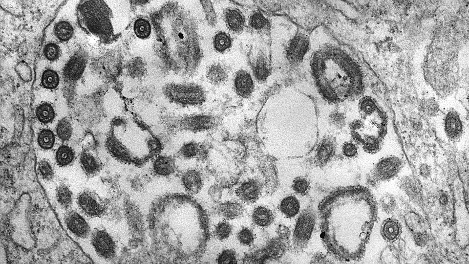 Marburg-Virus Mikroskop-Aufnahme