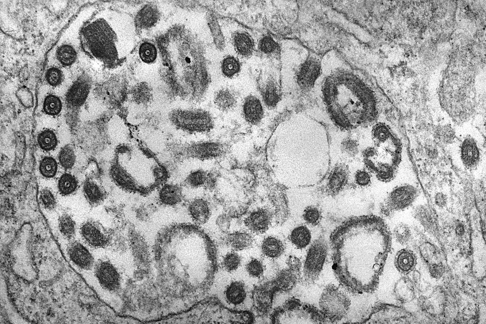 Marburg-Virus Mikroskop-Aufnahme