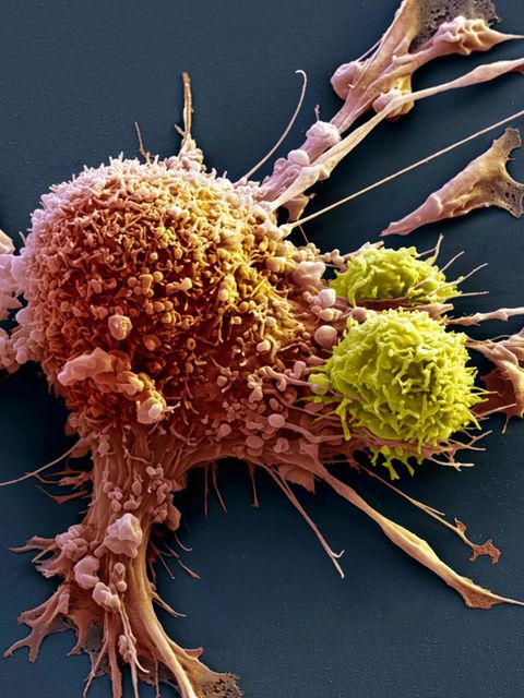 T-Zellen attackieren eine Krebszelle