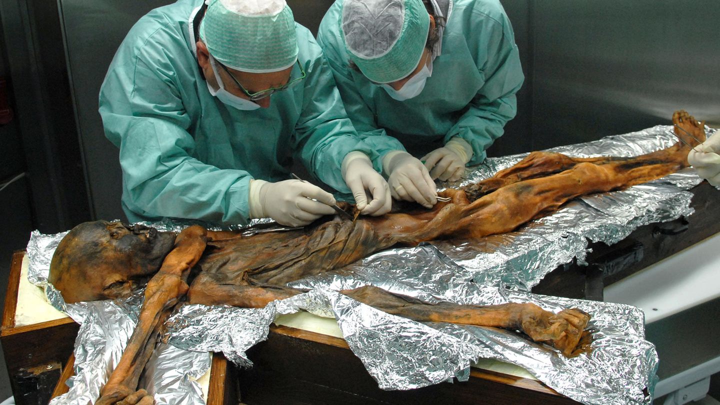Zwei Wissenschaftler untersuchen die Mumie von Ötzi