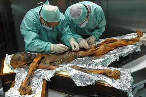 Zwei Wissenschaftler untersuchen die Mumie von Ötzi