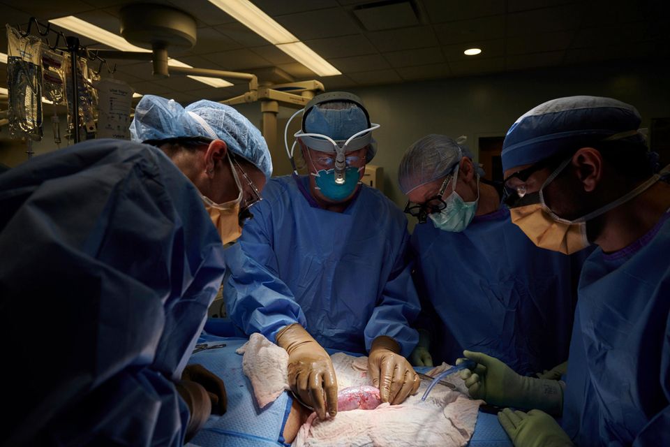 Ein Chirurgenteam untersucht eine Schweineniere am Körper eines Verstorbenen