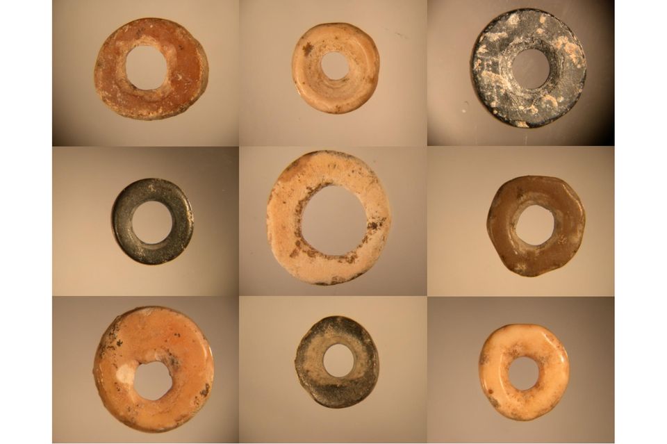 Digitalmikroskopische Aufnahmen von archäologischen Straußeneierschalen-Perlen