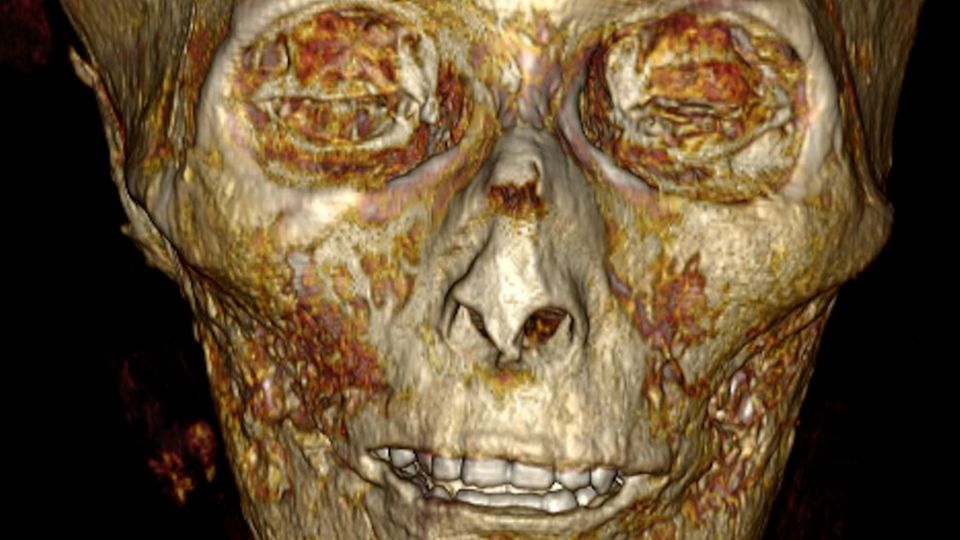 Im Schädel des Pharaos sind auch die Zähne gut erhalten