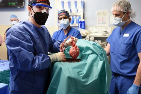 Erstmals Schweineherz-Transplantation für einen Menschen