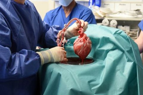 Schweineherz-Transplantation