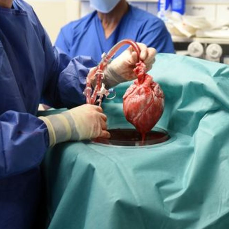 Schweineherz-Transplantation