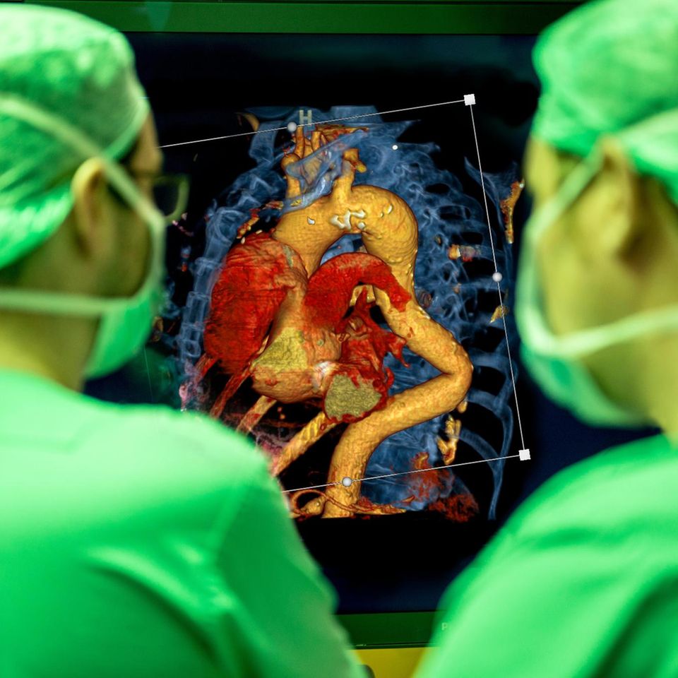Der durchleuchtete Mensch: Fast alle Patientendaten liegen heute digital vor (CT-Aufnahme eines Herzens mit Gefäßen). Algorithmen können in ihnen nach lebenswichtigen Informationen suchen