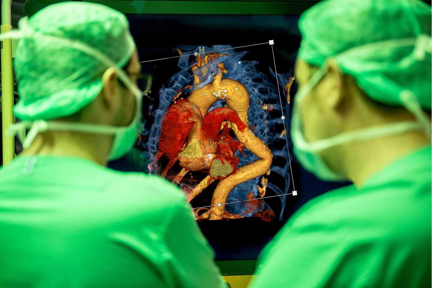 Der durchleuchtete Mensch: Fast alle Patientendaten liegen heute digital vor (CT-Aufnahme eines Herzens mit Gefäßen). Algorithmen können in ihnen nach lebenswichtigen Informationen suchen
