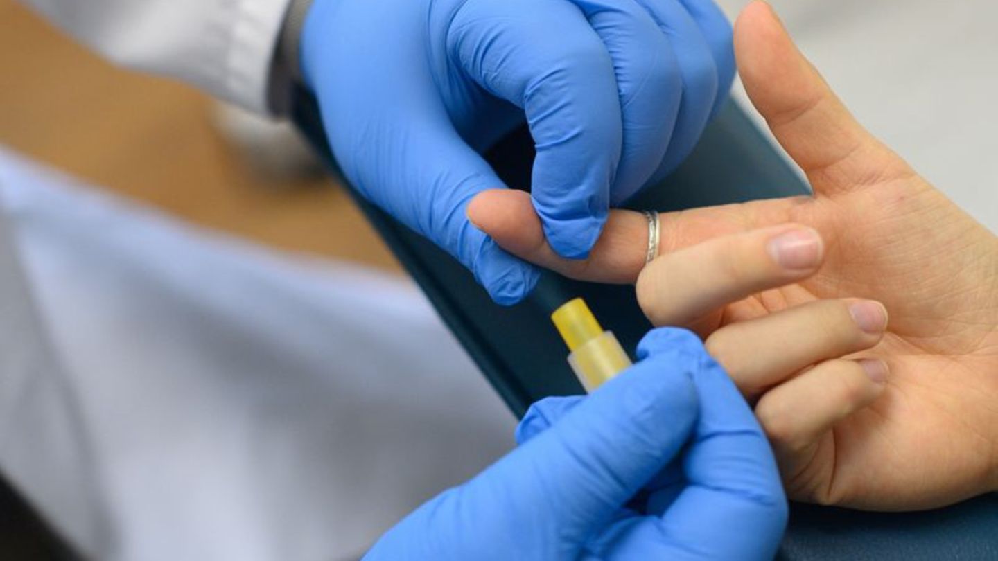 HIV-Test