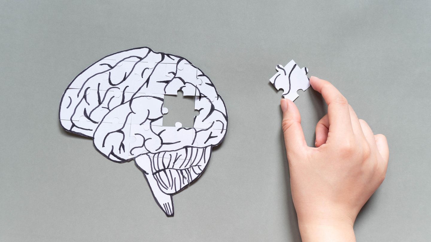Demenz und Alzheimer kann auch jüngere Menschen treffen