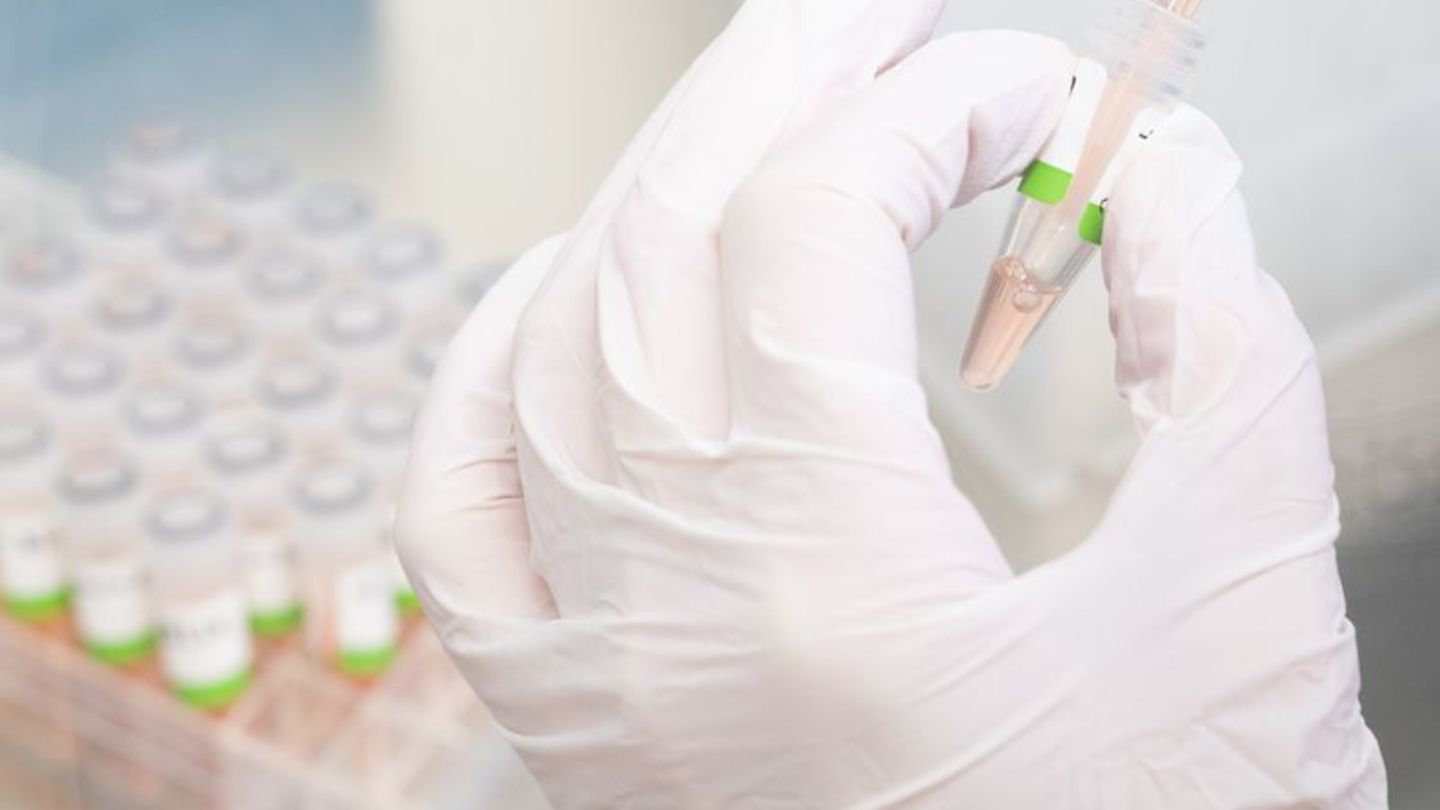 Eine biologisch-technische Assistentin bereitet PCR-Tests auf das Coronavirus vor