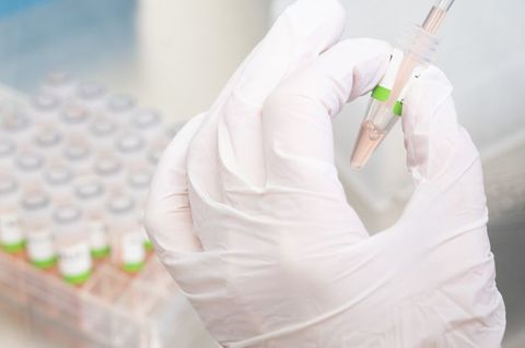 Eine biologisch-technische Assistentin bereitet PCR-Tests auf das Coronavirus vor