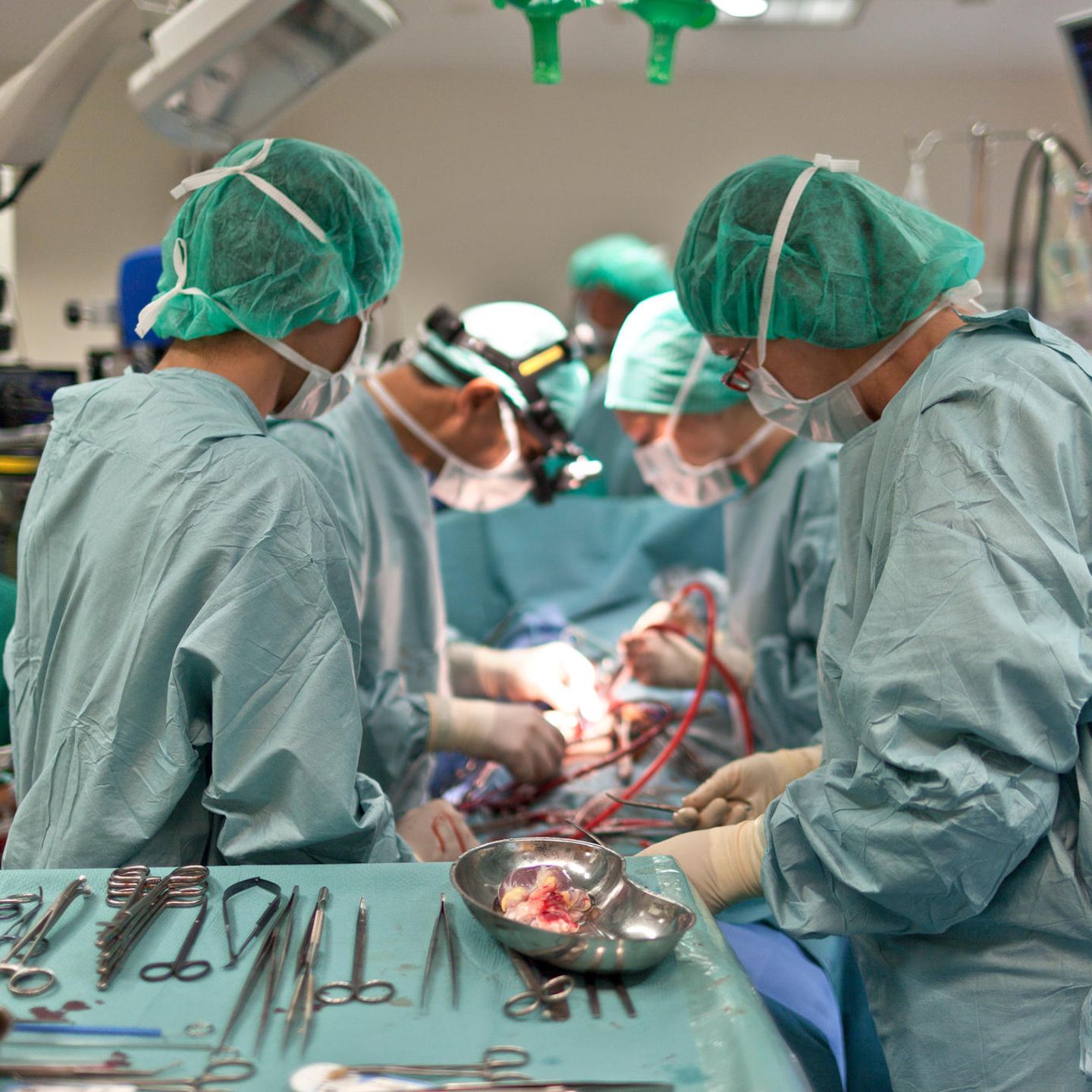 Weshalb so wenige Organe gespendet werden – und wie man dies ändern