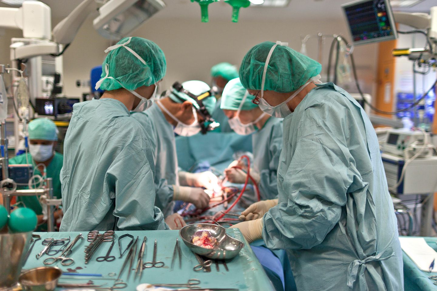 Ärzte im OP,  die ein Organ transplantieren