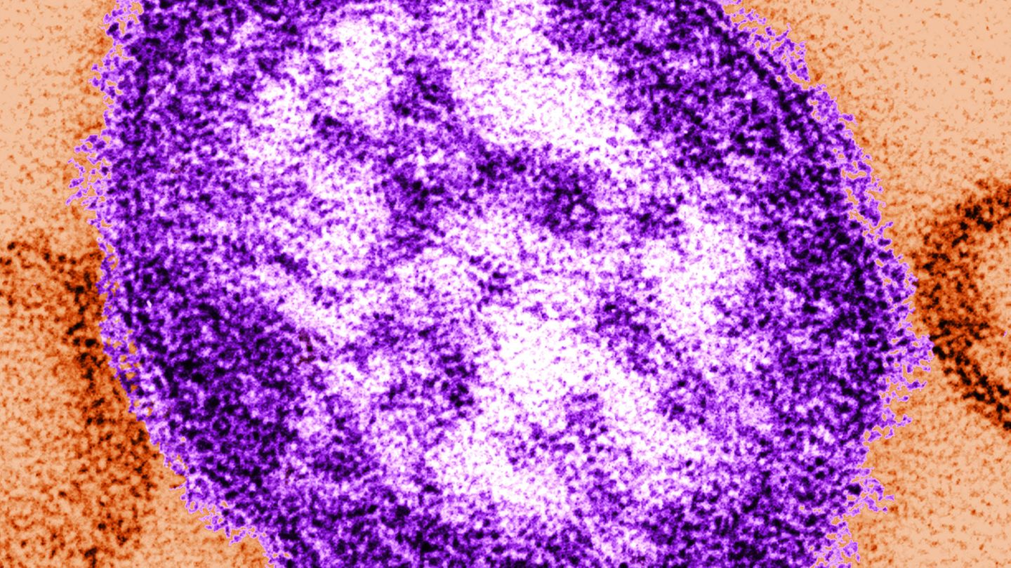 Masernvirus unter dem Transmissionselektronenmikroskop: Die Masern-Fälle weltweit steigen sehr rasch. Die Weltgesundheitsorganisation (WHO) sieht deshalb Millionen Kinder in Gefahr