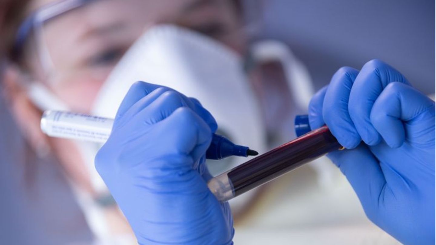 Ärztin beschriftet eine Blutprobe