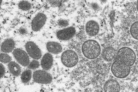 Affenpocken-Viren unter dem Mikroskop