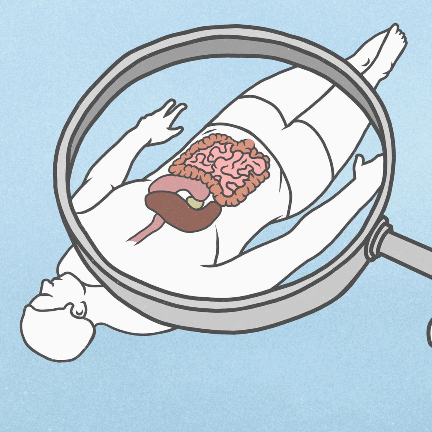 Zeichnung zeigt Darm eines Mannes unter einer Lupe