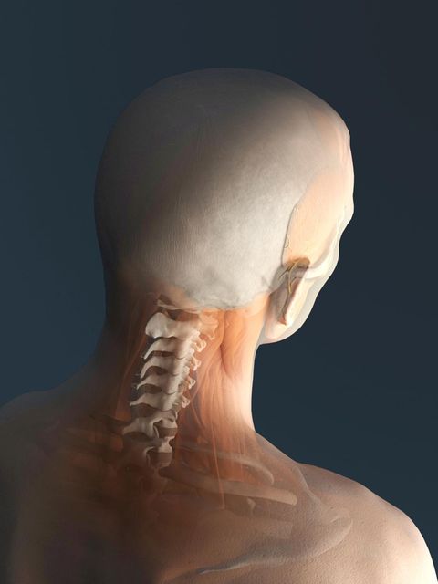 Viele Menschen halten einen schmer­zenden Nacken für den Auslöser von Kopfschmerzen. Tatsächlich ist es andersherum: Spannungskopfschmerz verursacht vielfach Nackenverspannung