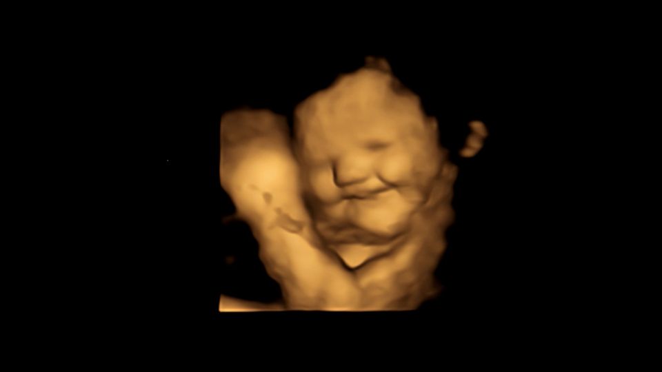 4D-Scan-Bild eines Fötus 4D-Scan-Bild eines Fötus