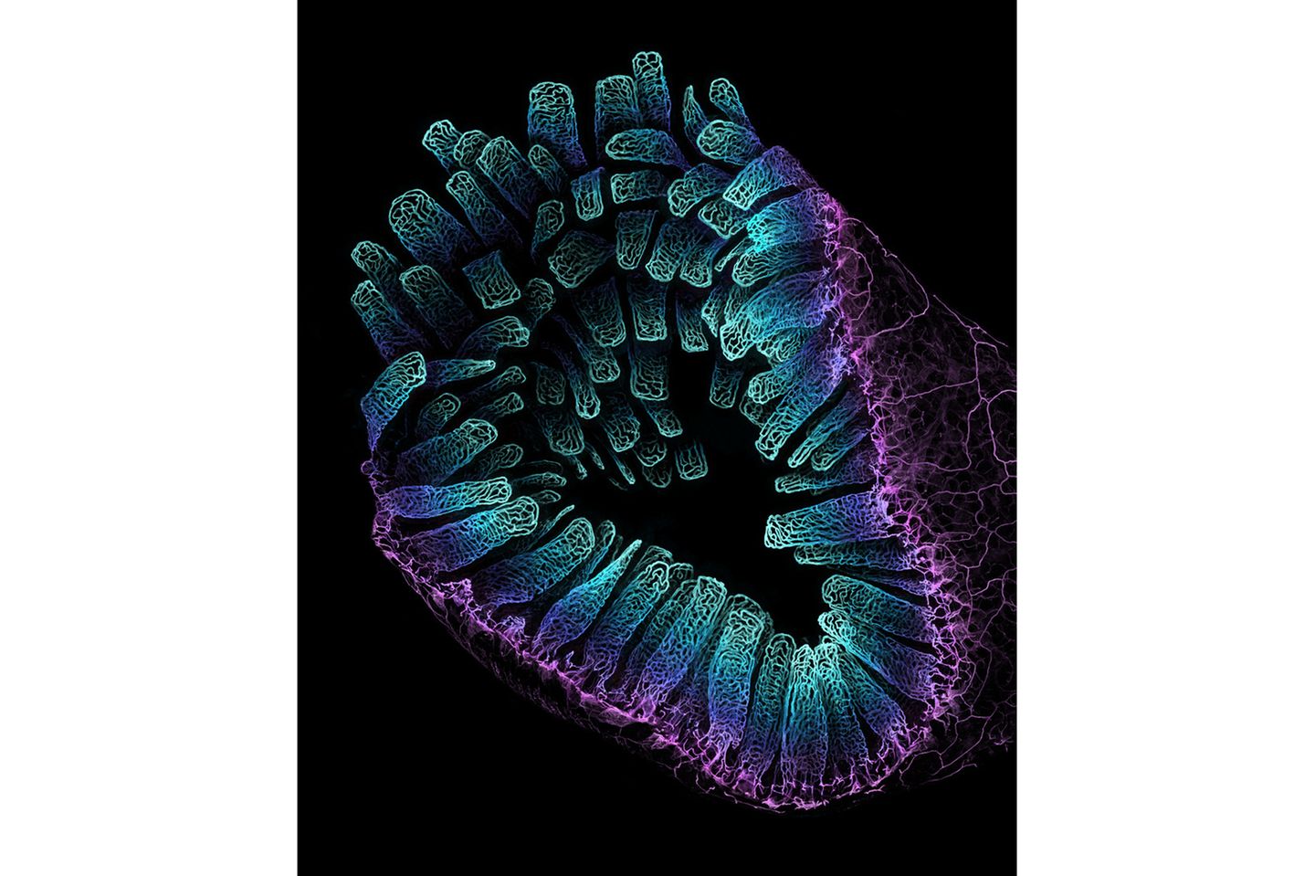 3rd Place    Satu Paavonsalo & Dr. Sinem Karaman    University of Helsinki    Individualized Drug Therapy Research Program, Faculty of Medicine    Helsinki, Finland    Blood vessel networks in the intestine of an adult mouse    Confocal    10X (Objective Lens Magnification)