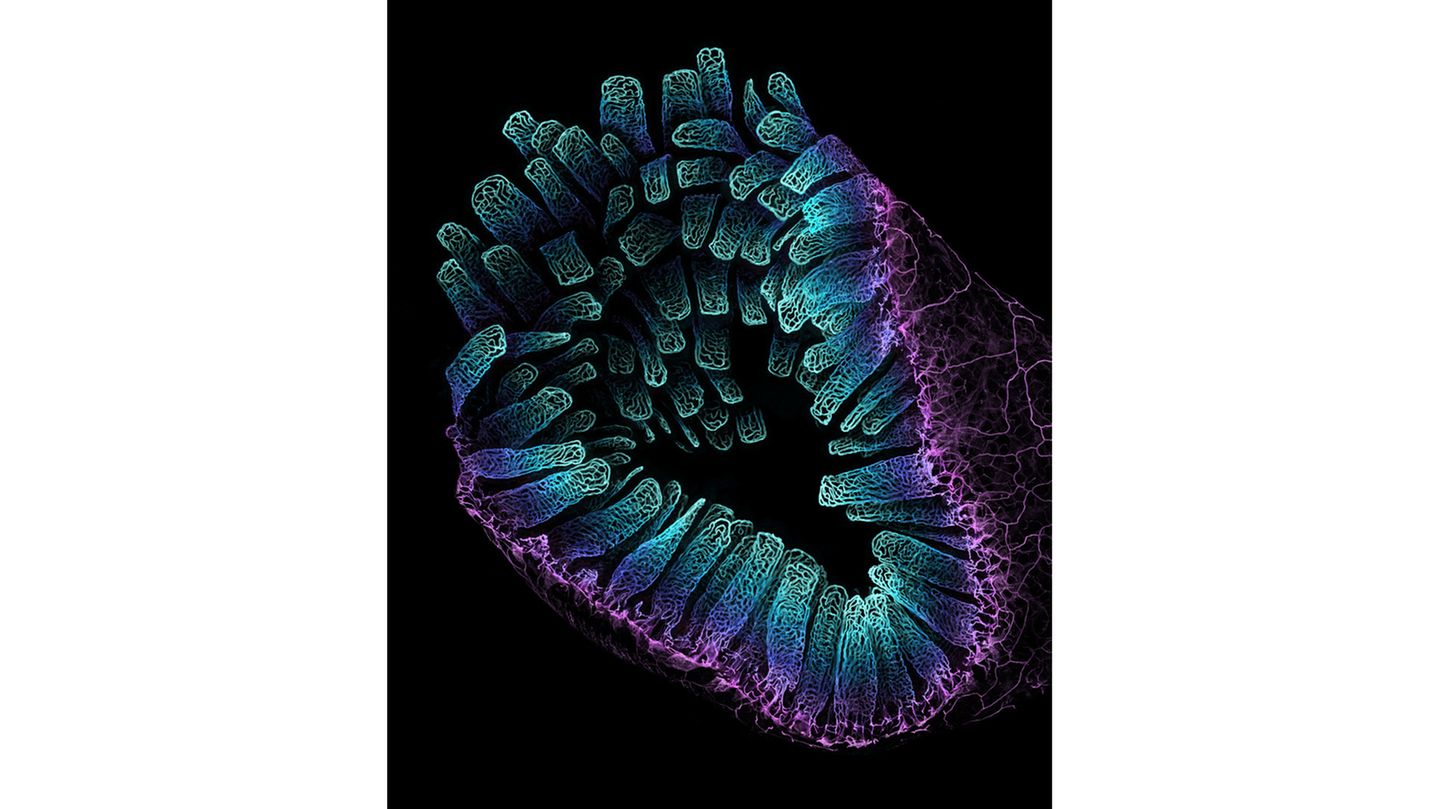 3rd Place    Satu Paavonsalo & Dr. Sinem Karaman    University of Helsinki    Individualized Drug Therapy Research Program, Faculty of Medicine    Helsinki, Finland    Blood vessel networks in the intestine of an adult mouse    Confocal    10X (Objective Lens Magnification)