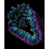 3rd Place    Satu Paavonsalo & Dr. Sinem Karaman    University of Helsinki    Individualized Drug Therapy Research Program, Faculty of Medicine    Helsinki, Finland    Blood vessel networks in the intestine of an adult mouse    Confocal    10X (Objective Lens Magnification)