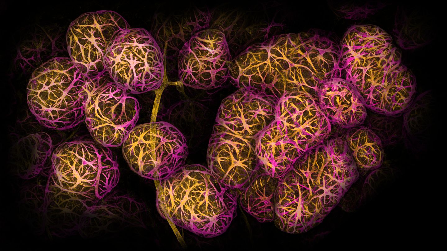 2nd Place    Dr. Caleb Dawson    WEHI, The Walter and Eliza Hall Institute of Medical Research    Department of Immunology    Melbourne, Victoria, Australia    Breast tissue showing contractile myoepithelial cells wrapped around milk-producing alveoli    Confocal    40X (Objective Lens Magnification)