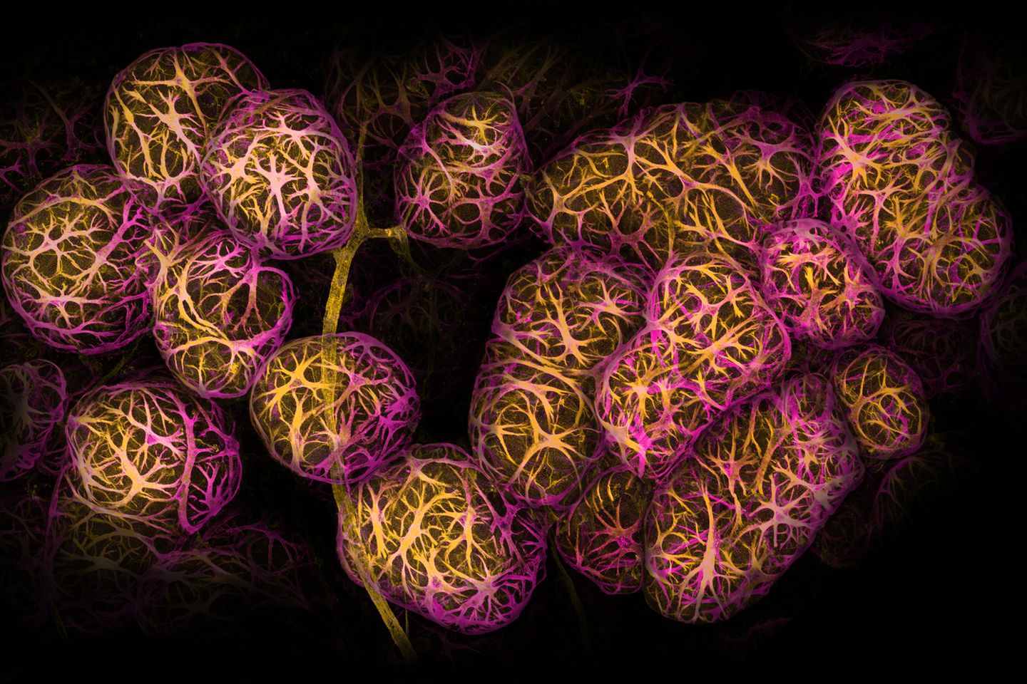 2nd Place    Dr. Caleb Dawson    WEHI, The Walter and Eliza Hall Institute of Medical Research    Department of Immunology    Melbourne, Victoria, Australia    Breast tissue showing contractile myoepithelial cells wrapped around milk-producing alveoli    Confocal    40X (Objective Lens Magnification)