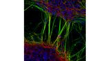 7th Place    Dr. Jianqun Gao & Prof. Glenda Halliday    University of Sydney    Central Clinical School / Professor Glenda Halliday's Lab    Sydney, New South Wales, Australia    Human neurons derived from neural stem cells (NSCs)    Confocal, Fluorescence    20X (Objective Lens Magnification)
