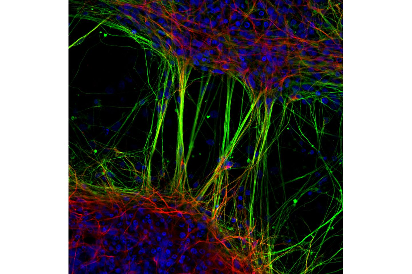 7th Place    Dr. Jianqun Gao & Prof. Glenda Halliday    University of Sydney    Central Clinical School / Professor Glenda Halliday's Lab    Sydney, New South Wales, Australia    Human neurons derived from neural stem cells (NSCs)    Confocal, Fluorescence    20X (Objective Lens Magnification)
