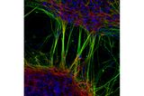 7th Place    Dr. Jianqun Gao & Prof. Glenda Halliday    University of Sydney    Central Clinical School / Professor Glenda Halliday's Lab    Sydney, New South Wales, Australia    Human neurons derived from neural stem cells (NSCs)    Confocal, Fluorescence    20X (Objective Lens Magnification)