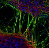 7th Place    Dr. Jianqun Gao & Prof. Glenda Halliday    University of Sydney    Central Clinical School / Professor Glenda Halliday's Lab    Sydney, New South Wales, Australia    Human neurons derived from neural stem cells (NSCs)    Confocal, Fluorescence    20X (Objective Lens Magnification)