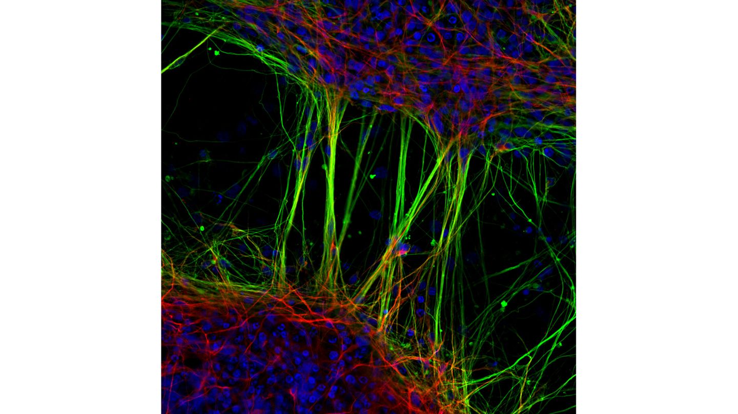7th Place    Dr. Jianqun Gao & Prof. Glenda Halliday    University of Sydney    Central Clinical School / Professor Glenda Halliday's Lab    Sydney, New South Wales, Australia    Human neurons derived from neural stem cells (NSCs)    Confocal, Fluorescence    20X (Objective Lens Magnification)