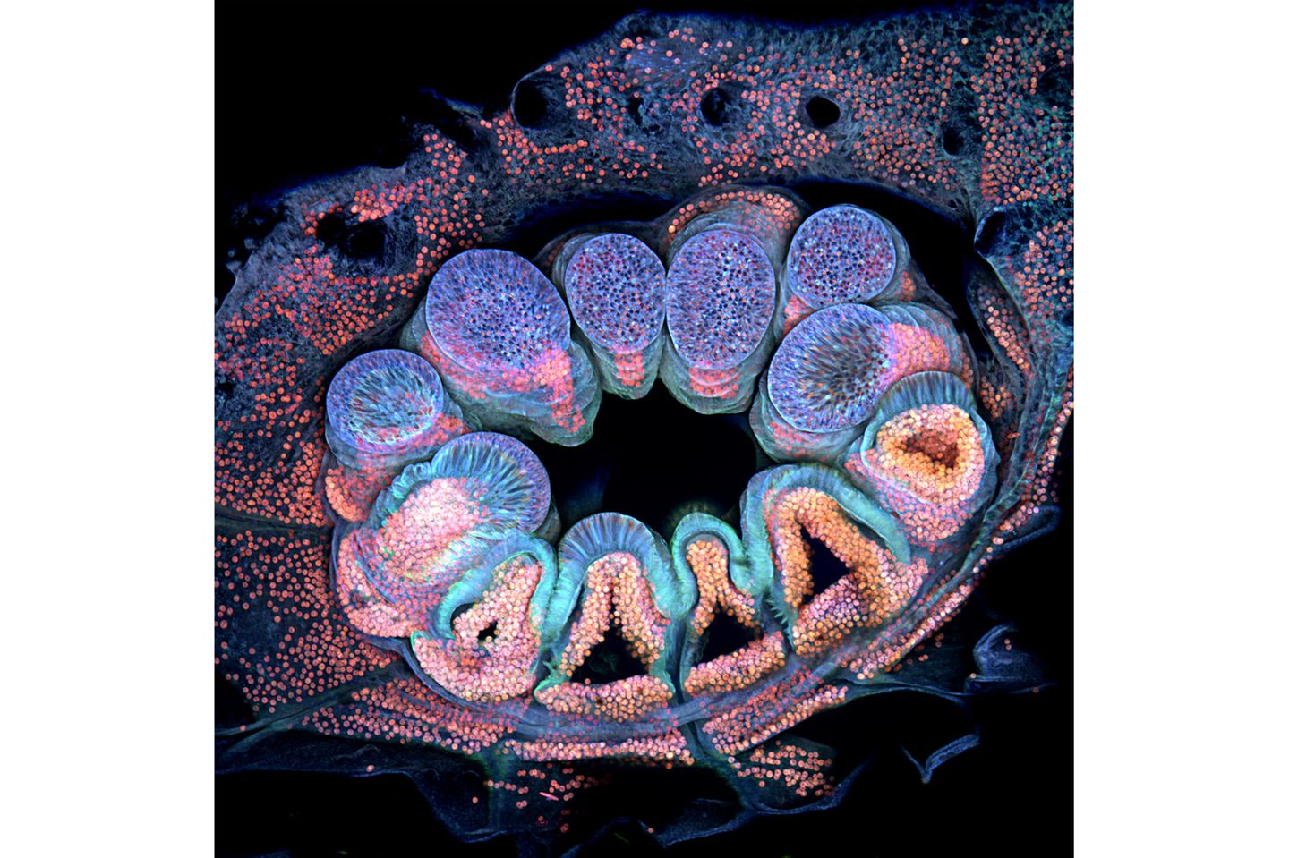 12th Place    Brett M. Lewis    Queensland University of Technology    Department of Earth and Atmospheric Science    Brisbane, Queensland, Australia    Autofluorescence of a single coral polyp (approx. 1 mm)     Fluorescence, Image Stacking    20X (Objective Lens Magnification)