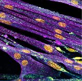 14th Place    Nadia Efimova    Amicus Therapeutics    Philadelphia, Pennsylvania, USA    Differentiated cultured mouse myoblasts with lysosomes (cyan/green), nuclei (yellow), F-actin (magenta)    Confocal    40X (Objective Lens Magnification)