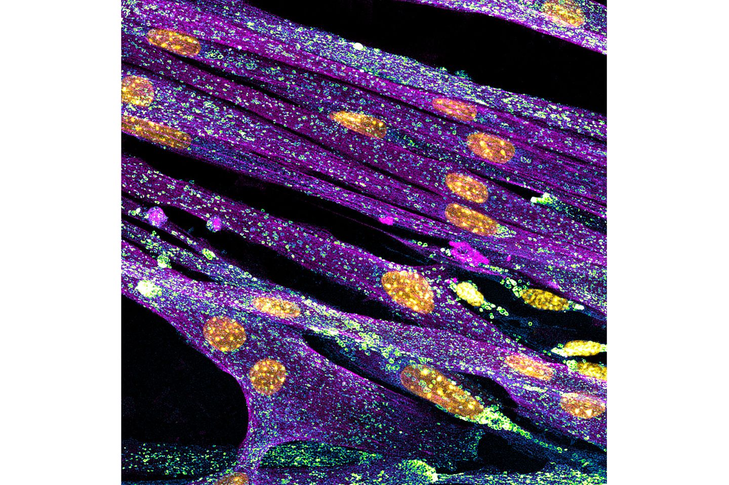 14th Place    Nadia Efimova    Amicus Therapeutics    Philadelphia, Pennsylvania, USA    Differentiated cultured mouse myoblasts with lysosomes (cyan/green), nuclei (yellow), F-actin (magenta)    Confocal    40X (Objective Lens Magnification)