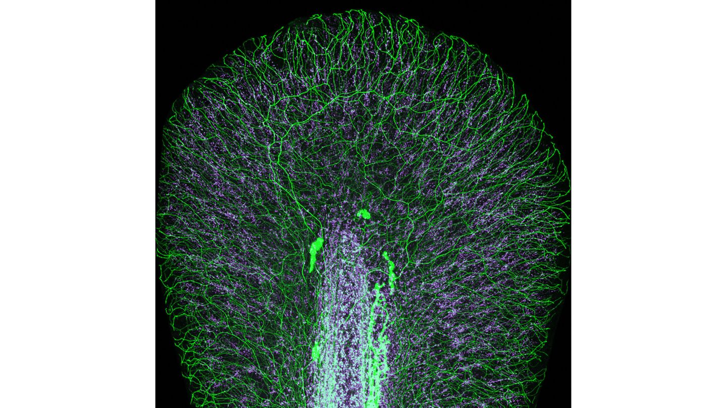 17th Place    Dr. Daniel Wehner & Julia Kolb    Max Planck Institute for the Science of Light    Department of Biological Optomechanics    Erlangen, Bavaria, Germany    Tail fin of a zebrafish larva with peripheral nerves (green) and extracellular matrix (violet)    Confocal    10X (Objective Lens Magnification)