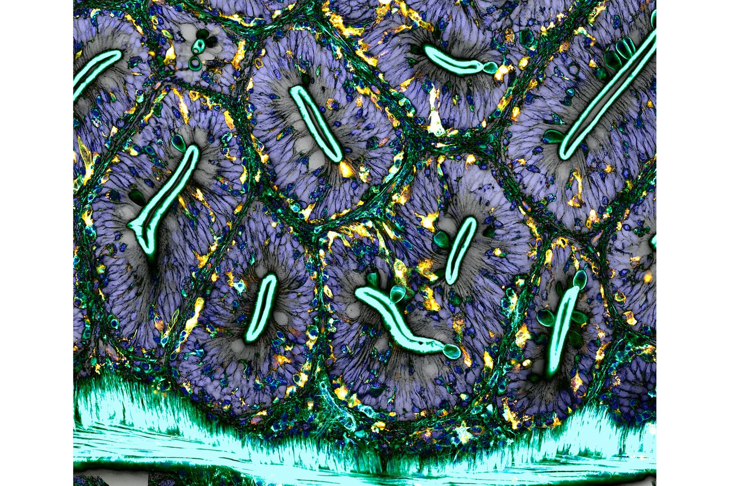 18th Place    Dr. Julien Resseguier    University of Oslo    Department of Biosciences / Immunology    Oslo, Viken, Norway    Network of macrophages (white blood cells) of an adult zebrafish intestine    Confocal, Deconvolution, Fluorescence    60X (Objective Lens Magnification)