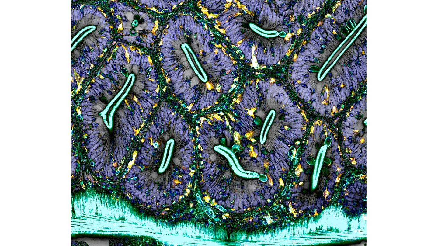 18th Place    Dr. Julien Resseguier    University of Oslo    Department of Biosciences / Immunology    Oslo, Viken, Norway    Network of macrophages (white blood cells) of an adult zebrafish intestine    Confocal, Deconvolution, Fluorescence    60X (Objective Lens Magnification)
