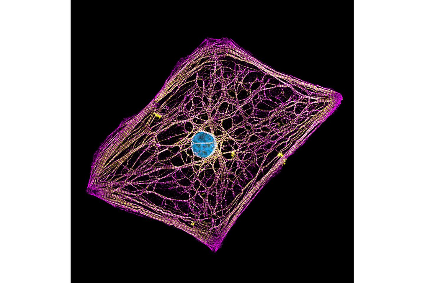 20th Place    Hui Lin & Dr. Kim McBride    Nationwide Children's Hospital    Center for Cardiovascular Research    Columbus, Ohio, USA    Human cardiomyocytes (heart cells) derived from induced pluripotent stem cells    Fluorescence    60X (Objective Lens Magnification)