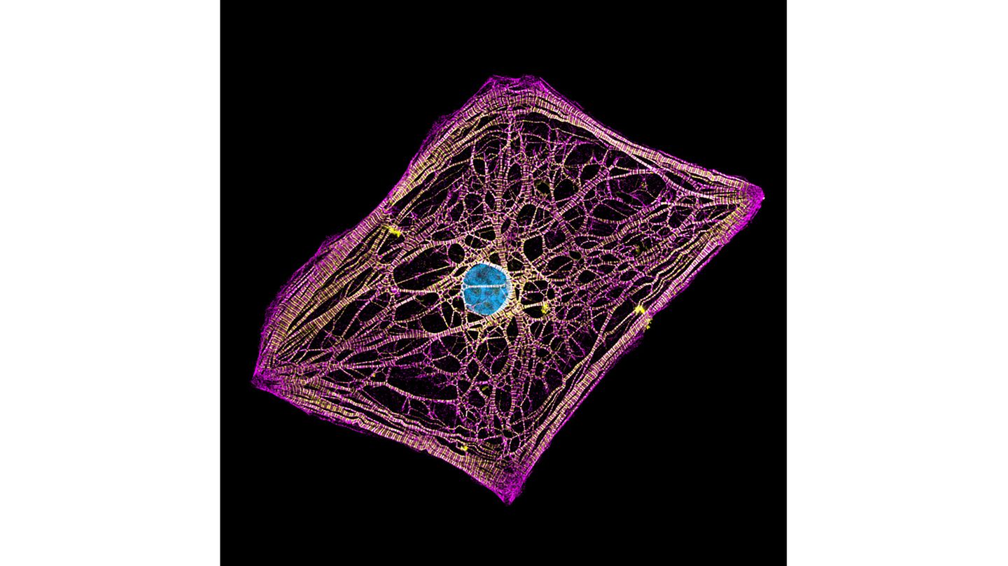 20th Place    Hui Lin & Dr. Kim McBride    Nationwide Children's Hospital    Center for Cardiovascular Research    Columbus, Ohio, USA    Human cardiomyocytes (heart cells) derived from induced pluripotent stem cells    Fluorescence    60X (Objective Lens Magnification)