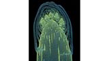 16th Place    Dr. Olivier Leroux    Ghent University    Department of Biology & Department of Plants and Crops    Ghent, Oost-Vlaanderen, Belgium    Longitudinal section through a white asparagus shoot tip    Fluorescence    10X (Objective Lens Magnification)