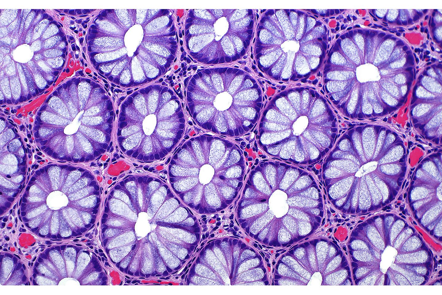 15th Place    Dr. Ziad El-Zaatari    Houston Methodist Hospital    Department of Pathology and Genomic Medicine    Houston, Texas, USA    Cross sections of normal human colon epithelial crypts    Brightfield    20X (Objective Lens Magnification)